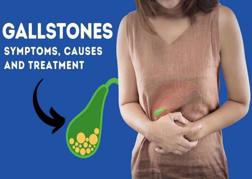 Gallbladder Stones: Symptoms, Causes and Treatment at Holy Promise Hospital पित्ताशय की पथरी: Holy Promise Hospital में लक्षण, कारण और उपचार की जानकारी